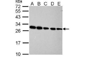 Western Blotting (WB) image for anti-Prohibitin (PHB) antibody (ABIN2854938)