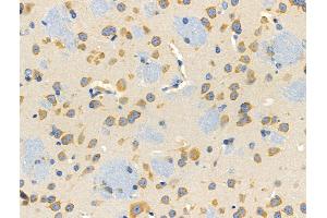 ABIN6257892 and ABIN6274756 at 1/100 staining Mouse brain tissue by IHC-P. (RPS4X Antikörper  (Internal Region))