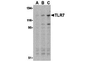Western Blotting (WB) image for anti-Toll-Like Receptor 7 (TLR7) (Middle Region) antibody (ABIN1031131) (TLR7 Antikörper  (Middle Region))