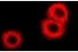 Immunofluorescent analysis of PSAT1 staining in U2OS cells. (PSAT1 Antikörper)