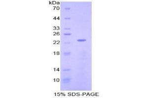 SDS-PAGE analysis of Mouse NME3 Protein. (NME3 Protein)