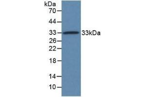 Western Blot - Sample: Recombinant TXLNa, Human; Antibody: Rabbit Anti-Human TXLNa Ab (ABIN7646889, ABIN7711216, ABIN7711218, ABIN7711220)