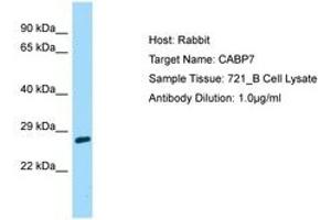 Image no. 1 for anti-Calcium Binding Protein 7 (CABP7) (AA 137-186) antibody (ABIN6750164) (CABP7 Antikörper  (AA 137-186))