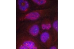 Immunofluorescence staining of methanol-fixed HeLa cells using Phospho-RELA-S276 antibody. (NF-kB p65 Antikörper  (pSer276))