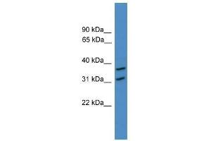Western Blot showing OTUD6A antibody used at a concentration of 1-2 ug/ml to detect its target protein. (OTUD6A Antikörper  (N-Term))