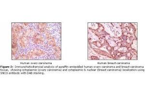 Image no. 1 for anti-Synuclein, gamma (Breast Cancer-Specific Protein 1) (SNCG) antibody (ABIN207620) (SNCG Antikörper)
