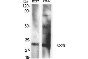 Western Blot (WB) analysis of specific cells using ACOT8 Polyclonal Antibody.