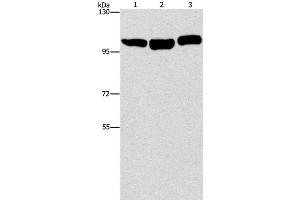 Western Blot analysis of Hela, NIH/3T3 and Raji cell using DNM2 Polyclonal Antibody at dilution of 1:400 (DNM2 Antikörper)