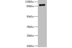 Western blot All lanes: RRM1 antibody at 2 μg/mL + Hela whole cell lysate Secondary Goat polyclonal to rabbit IgG at 1/10000 dilution Predicted band size: 91 kDa Observed band size: 91 kDa (RRM1 Antikörper  (AA 1-792))