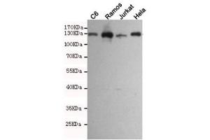 Western blot testing of rat C6 and human Ramos, Jurkat and HeLa cell lysates using JAK1 antibody at 1:1000. (JAK1 Antikörper)