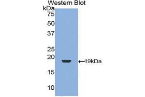 Western blot analysis of the recombinant protein. (TGFB1 Antikörper  (AA 279-390))