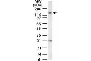Western blot analysis of HDAC-4 in Jurkat cell lysate with HDAC4 polyclonal antibody  . (HDAC4 Antikörper  (AA 194-209))