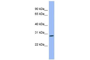 WB Suggested Anti-PENK Antibody Titration: 0. (Enkephalin Antikörper  (Middle Region))