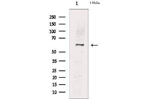 Western blot analysis of extracts from Hela cells, using PKM2(phospho-Ser37) Antibody. (PKM Antikörper  (pSer37))
