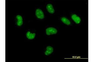 Immunofluorescence of purified MaxPab antibody to CUTC on HeLa cell.