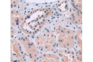 Used in DAB staining on fromalin fixed paraffin- embedded kidney tissue (BCAT2 Antikörper  (AA 107-392))