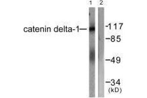 Western blot analysis of extracts from HuvEc cells, using Catenin-δ1 (Ab-228) antibody. (CTNND1 Antikörper  (Tyr228))