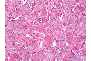 Image no. 1 for anti-Transferrin (TF) antibody (ABIN471288) (Transferrin Antikörper)