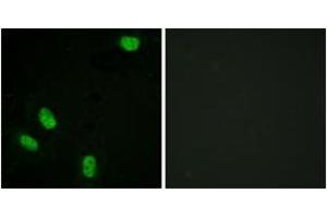 Immunofluorescence analysis of HeLa cells, using Progesterone Receptor (Phospho-Ser294) Antibody. (Progesterone Receptor Antikörper  (pSer294))