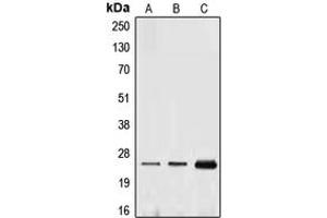 Western blot analysis of Ephrin A1 expression in THP1 (A), HUVEC (B), MCF7 (C) whole cell lysates. (Ephrin A1 Antikörper  (Center))
