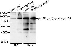 Western blot analysis of extracts of various cell lines, using Phospho-PKC (pan) (gamma)-T514 antibody. (PRKCA beta 2 Antikörper  (pThr497))