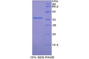 SDS-PAGE analysis of Mouse CDK4 Protein.