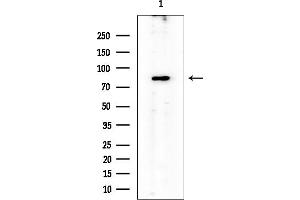 anti-Protein Kinase D1 (PRKD1) antibody