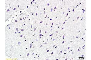 Formalin-fixed and paraffin embedded rat brain labeled with Anti KCNN4 Polyclonal Antibody, Unconjugated (ABIN719786) at 1:200 followed by conjugation to the secondary antibody and DAB staining (KCNN4 Antikörper  (AA 325-427))