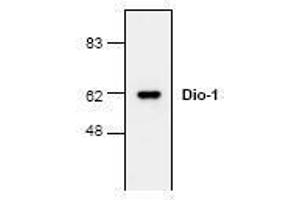 Image no. 1 for anti-Death Inducer-Obliterator 1 (DIDO1) (N-Term) antibody (ABIN127222) (DIDO1 Antikörper  (N-Term))