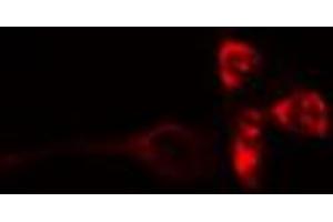 ABIN6272379 staining COLO205 by IF/ICC. (OTUB2 Antikörper  (Internal Region))