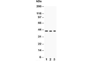 Western blot testing of GAP43 antibody and Lane 1:  U87 (GAP43 Antikörper)