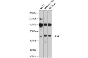 Western blot analysis of extracts of various cell lines, using ZIC3 antibody (ABIN6133228, ABIN6150444, ABIN6150446 and ABIN6225011) at 1:1000 dilution. (ZIC3 Antikörper  (AA 1-240))