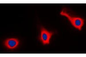 Immunofluorescent analysis of CD9 staining in HEK293T cells. (CD9 Antikörper  (Center))