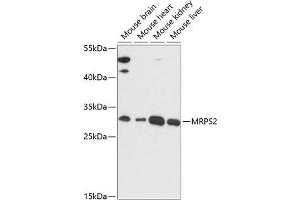 Western blot analysis of extracts of various cell lines, using MRPS2 antibody (ABIN7268584) at 1:3000 dilution. (MRPS2 Antikörper  (AA 1-296))