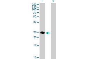 Western Blot analysis of ZNF486 expression in transfected 293T cell line by ZNF486 MaxPab polyclonal antibody. (ZNF486 Antikörper  (AA 1-216))
