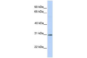 WB Suggested Anti-RNF148 Antibody Titration:  0. (RNF148 Antikörper  (C-Term))