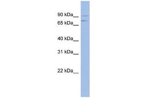 WB Suggested Anti-MTMR12 Antibody Titration: 0. (MTMR12 Antikörper  (Middle Region))