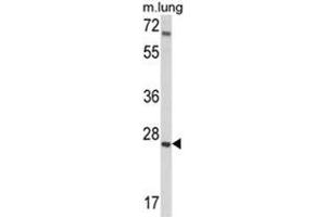 Western blot analysis of IGFBP4 Antibody (N-term) in mouse lung tissue lysates (35ug/lane). (IGFBP4 Antikörper  (N-Term))