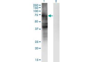 Western Blot analysis of SLC4A4 expression in transfected 293T cell line by SLC4A4 monoclonal antibody (M01), clone 1G2.