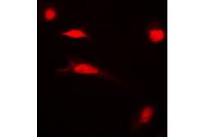 Immunofluorescent analysis of Histone H3 (AcK27) staining in HeLa cells. (Histone 3 Antikörper  (H3K27ac))