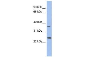 WBP2NL antibody used at 1 ug/ml to detect target protein.