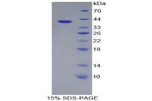 SDS-PAGE (SDS) image for Apolipoprotein A-II (APOA2) (AA 24-102) protein (His tag,GST tag) (ABIN1879895)
