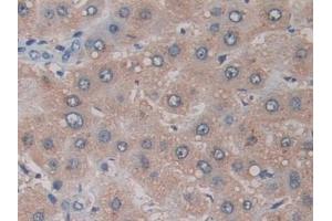 Immunohistochemistry (IHC) image for anti-ADAM Metallopeptidase Domain 17 (ADAM17) (AA 226-473) antibody (ABIN7426310)