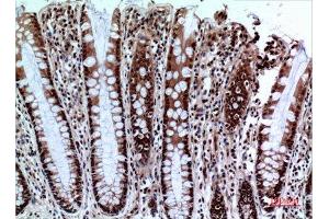 Immunohistochemistry (IHC) analysis of paraffin-embedded Human Colon, antibody was diluted at 1:100.