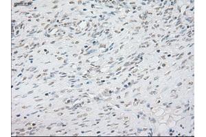 Immunohistochemical staining of paraffin-embedded lung tissue using anti-NEUROG1mouse monoclonal antibody. (Neurogenin 1 Antikörper)