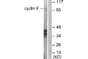 Western blot analysis of extracts from HeLa cells, using Cyclin F antibody (#C0168). (Cyclin F Antikörper)