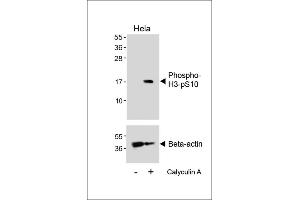 Western blot analysis of lysates from Hela cell line, untreated or treated with 20 % FBS + 100nM Calyculin A, using Phospho-HIST1H3B3(S10) Antibody (upper) or Beta-actin (lower). (HIST1H3B3 (pSer10) Antikörper)