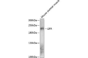 Western blot analysis of extracts of mouse skeletal muscle, using LIFR antibody (ABIN6132110, ABIN6143204, ABIN6143205 and ABIN6216534) at 1:3000 dilution. (LIFR Antikörper  (AA 500-700))