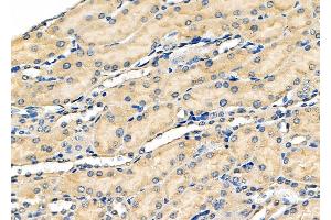 ABIN6259879 and ABIN6278421 at 1/100 staining Mouse kidney tissue by IHC-P. (ALDH3A1 Antikörper  (C-Term))