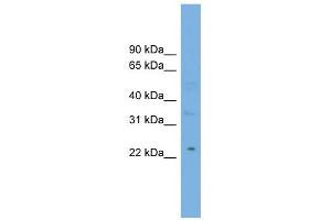 WB Suggested Anti-MBL2 Antibody Titration:  0. (MBL2 Antikörper  (Middle Region))